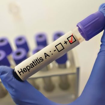 hepatita-a